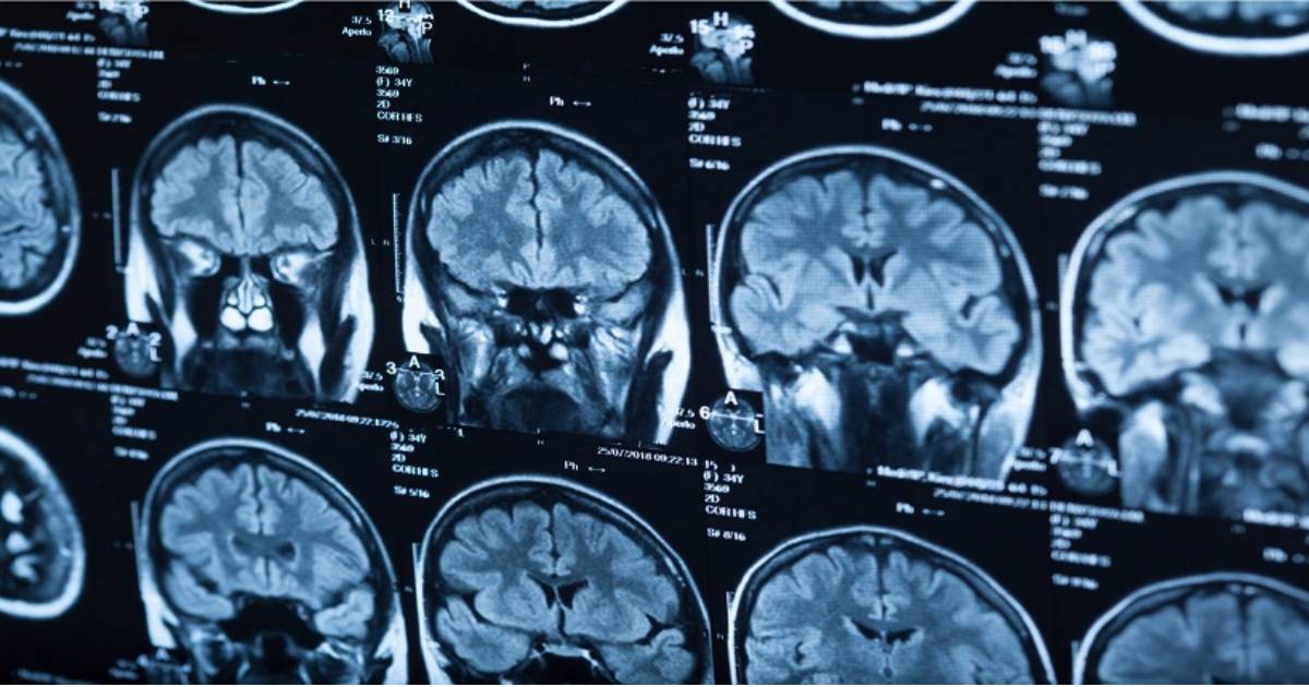 Scans of a human brain